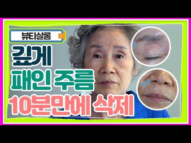 이마주름/눈가주름/팔자주름 우리 얼굴에 있는 모든 주름 10분만 투자하면 지울 수 있다?! MBN 210803 방송