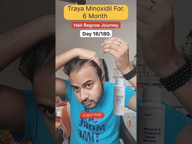 Day 16/180 Hair Regrow journey with Traya Minoxidil  #minoxidil #traya #hairregrowth