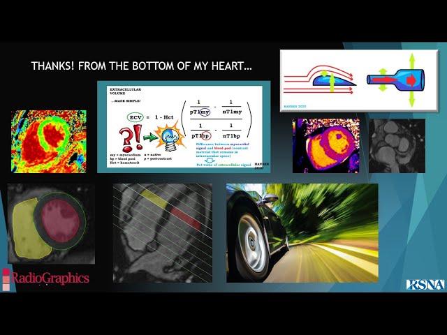 QUANTIFICATION IN CARDIAC MRI