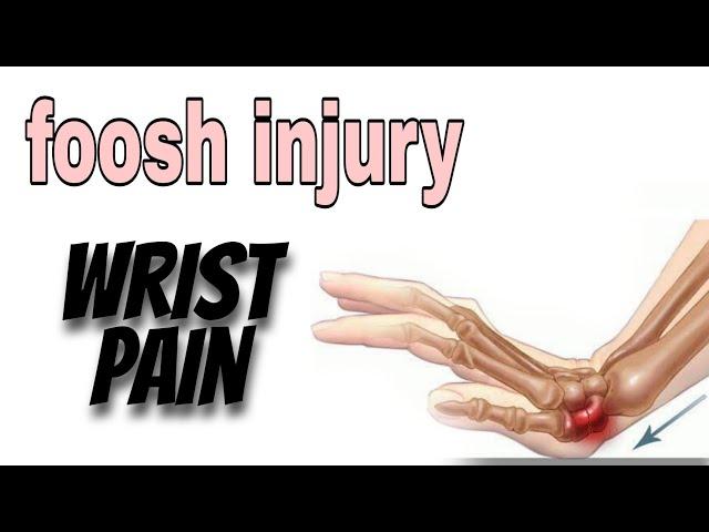 FOOSH - Fall on Outstretch hand (Wrist Pain) Part 1 | House Physiotherapy