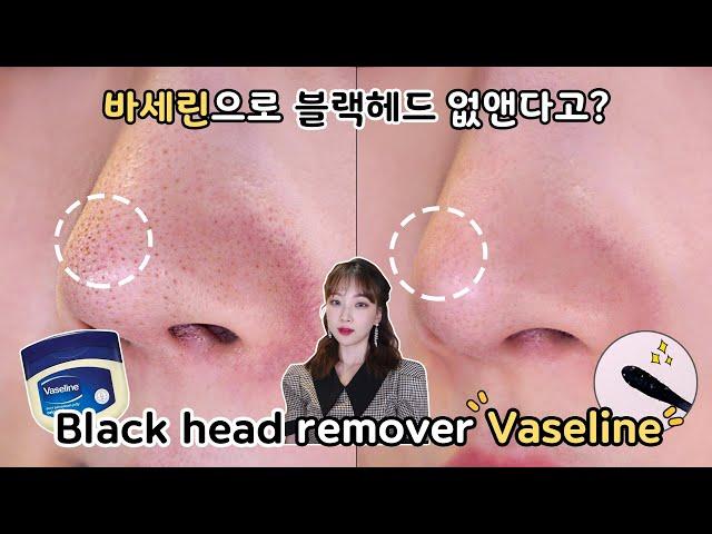 Is it possible to get rid of blackheads with Vaseline? nose blackhead, removing sebum