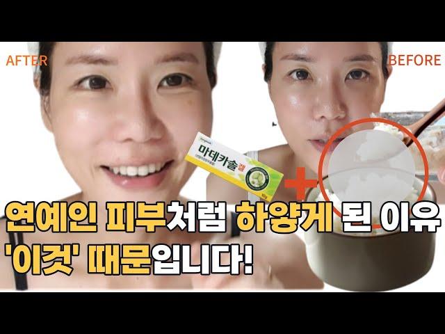 누구나 쉽게 피부 하얘지는 방법 | 마데카솔겔 팩 바세린 팩 바로 전단계에 '이걸' 해 줘야 미친 효과를 볼 수 있어요ㅣ백옥같은 피부 만드는 비결 Part1