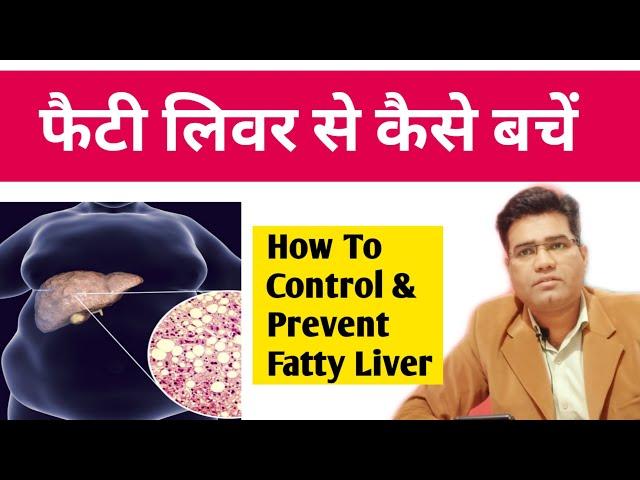 Fatty Liver बीमारी से बचने का उपाय | फैटी लीवर Control kaise Karen | Dr Santosh Singh