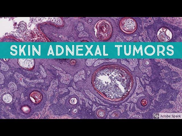 Skin Adnexal Tumors: Dermatopathology Unknown Cases