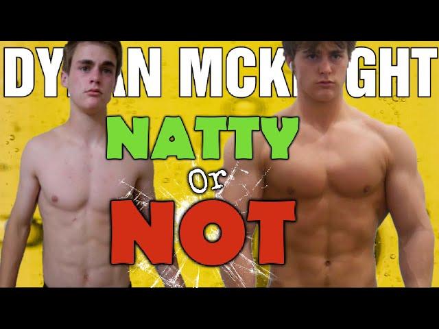 Dylan McKnight || NATTY or NOT?