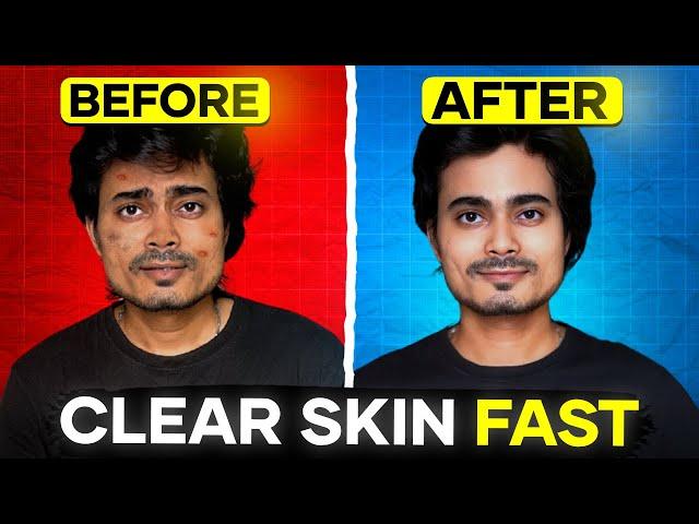 The SECRET to FAST CLEAR SKIN No One Tells You About