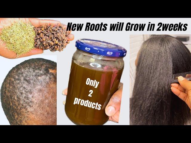 CLOVES $ ROSEMARY WATER FOR FAST HAIR GROWTH.