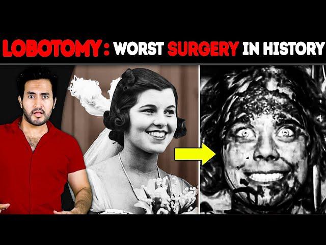 Why is LOBOTOMY The WORST Surgery in History