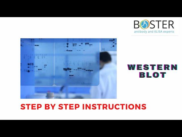 WESTERN BLOT PROTOCOL | Step by step instructions