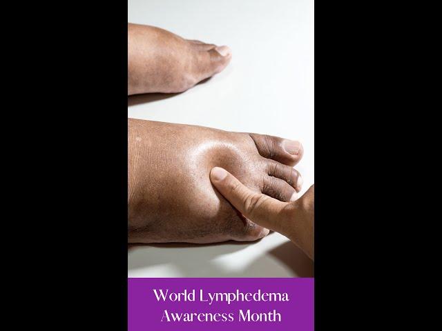 World Lymphedema Awareness Month