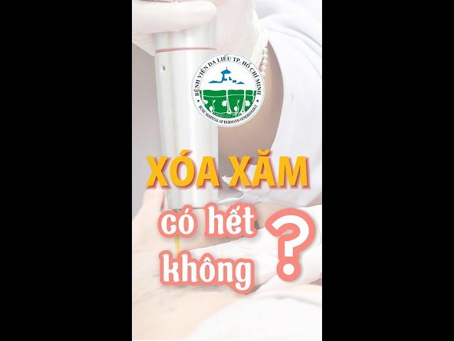 XÓA XĂM CÓ HẾT KHÔNG?|| Bệnh viện Da Liễu TP.HCM
