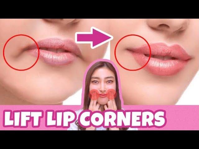 Lift Lip Corners, Fix Droopy Mouth Corners, Fat Around The Mouth, Sagging Cheeks.NO SURGERY