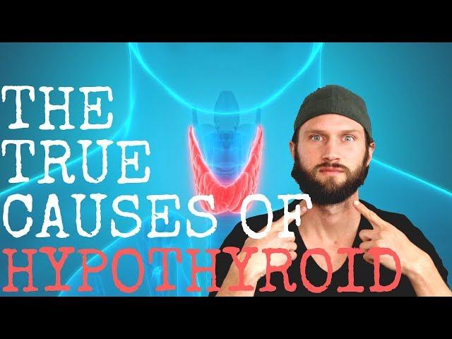 HYPOTHYROID: The Untold TRUE Causes