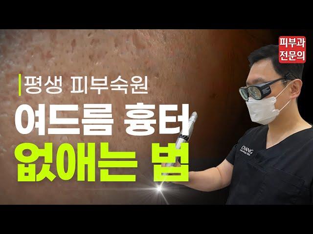 여드름 흉터 치료 총정리! 과연 얼마나 좋아질까?- 여드름 흉터 없애는 법
