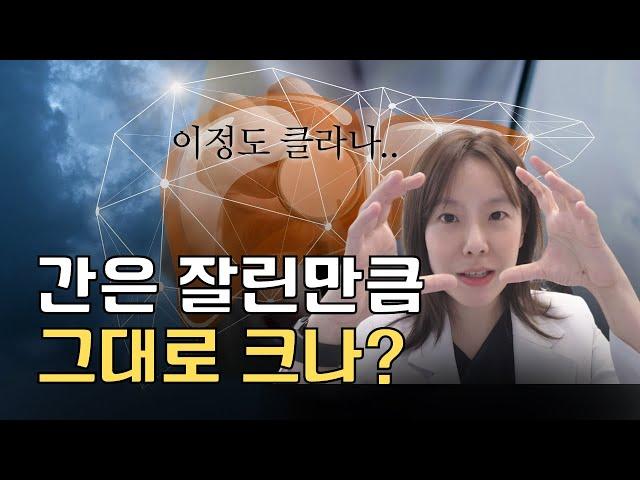 간은 잘린만큼 그대로 크나?