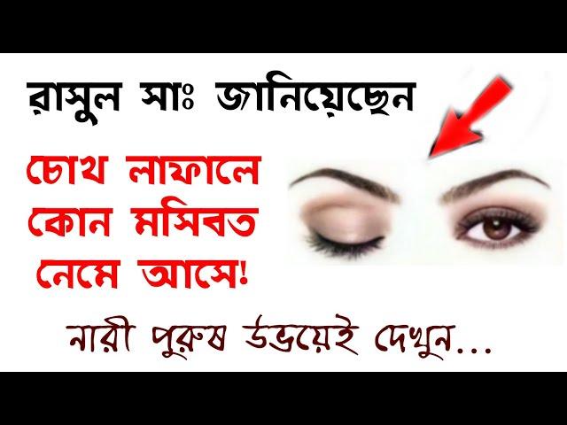 রাসুল সাঃ জানিয়েছেন চোখ লাফালে কি বিপদ হতে পারে | zubayer bin emam | ইসলামিক ভিডিও | Islamic Amol