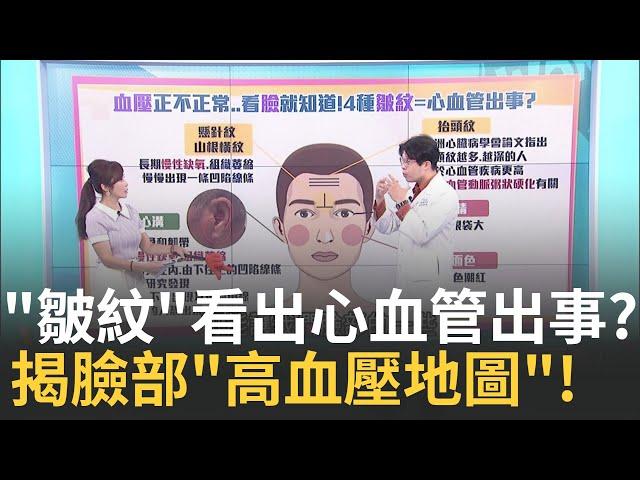 "耳垂一道+抬頭紋深" 死於心血管疾病機率更高?! 不是玄學!"眼乾、眼袋大、臉紅"高血壓看臉就知!｜主播 黃倩萍｜【醫點不誇張】20241223｜三立iNEWS