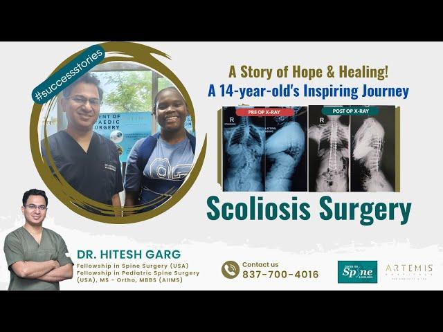 Kenyan Girls' Journey to Successful Scoliosis Surgery in India : A Story of Hope and Healing