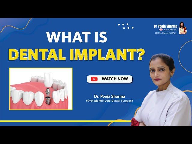 What Are Dental Implant? Procedure & Benefit - Dental Treatment in Agra, India | Dr Pooja Sharma