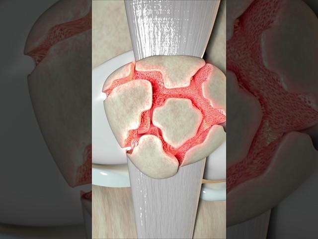 What Type of Knee Fracture Is This? (Quiz)