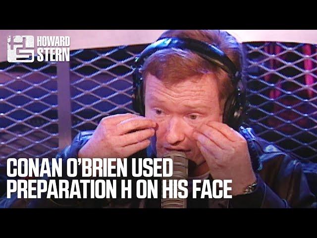 Conan O’Brien Used Preparation H on His Face (1999)
