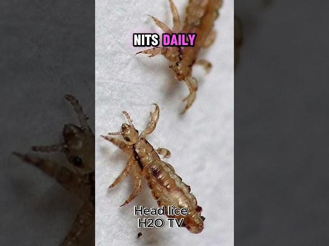 || Maybe You Don't Know || Head Lice: Parasites Living on the Human Scalp #top10 #top #wildlife #sho