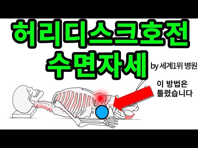 허리통증 치료되는 수면자세 이방법만 따라하세요!! 통증이 싹 없어집니다!!