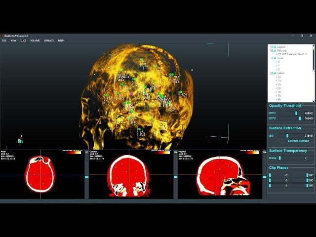 How to create Labels or Landmarks over 3D DICOM or Volume Images in Real3d VolViCon?