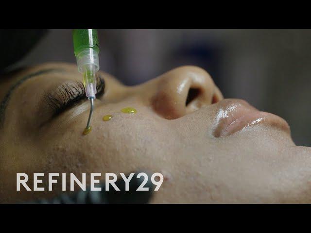 I Tried a Chemical Peel for 'Glass Skin': BioRePeel | Macro Beauty | Refinery29