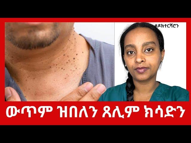 ኣብ ቆርበት ዝወጽእ ውጥም ውጥም ዝበለን ጸሊም ክሳድን ዝምለሰሉ ቀሊል ኣገባብ