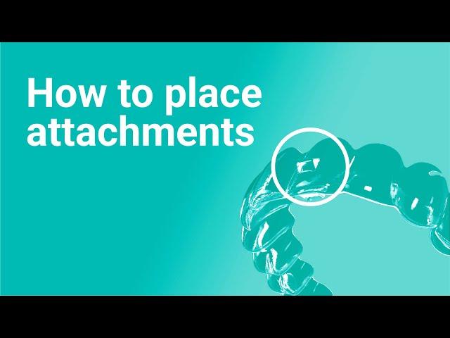 How to Place Attachments in Aligners [Avoid These Common Mistakes!]