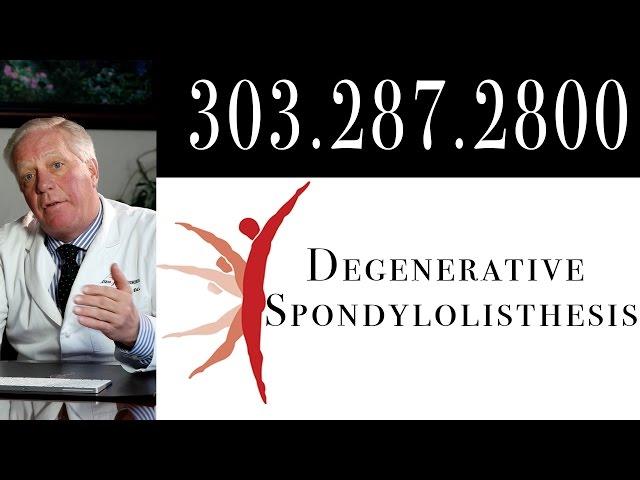 Degenerative Spondylolisthesis | Denver Spine Surgeons - Dr. Janssen