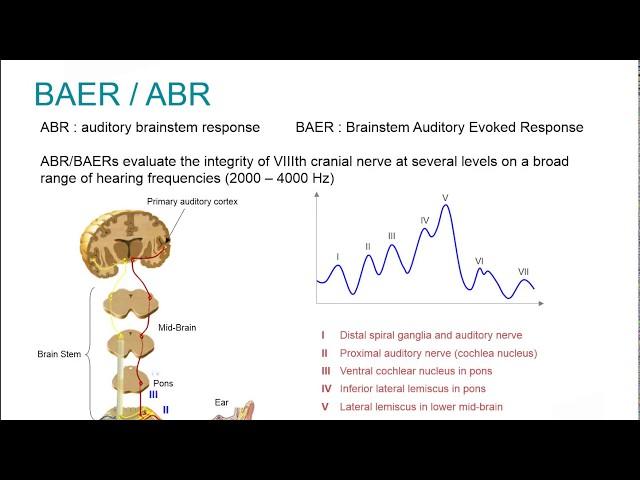 Natus EP Webinar: Clinical Auditory Evoked Potentials