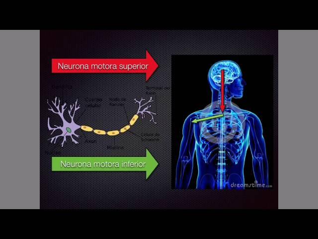 Neurona motora superior e inferior