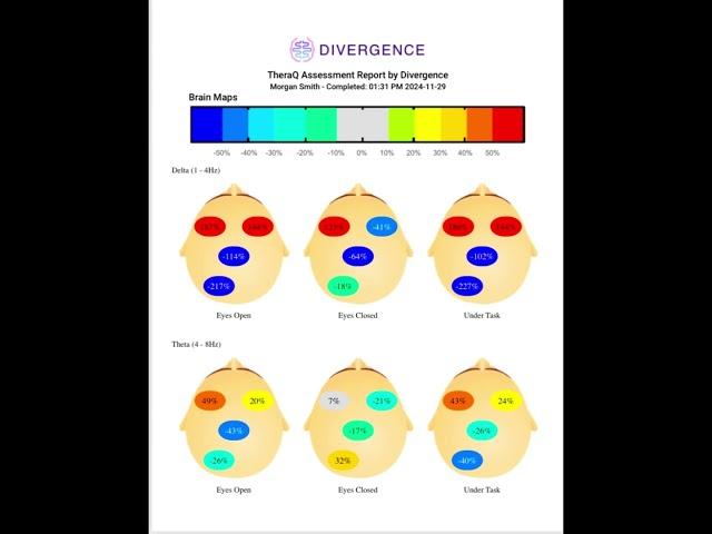 Exploring the Mind of an Advanced Meditator Pt 2  #brainwave #brainwaveentrainment #neurocognitive