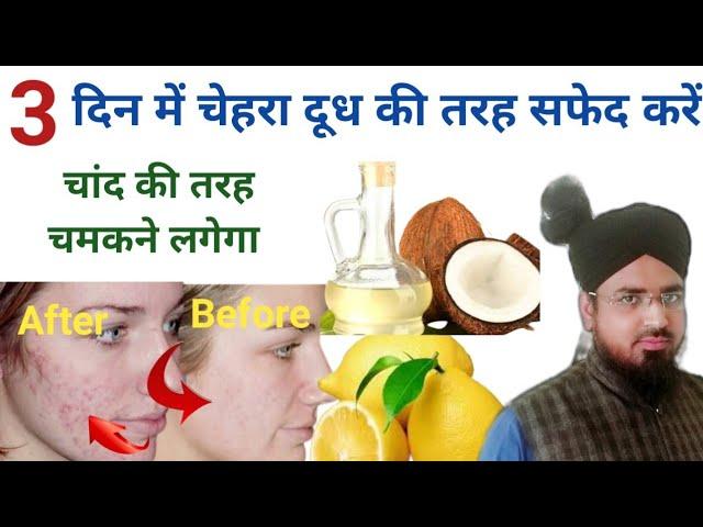 Chehre Ka Rang Gora Karne Ka Asan Tareeqa || 3 Din Me Chehra Hoga Chaand Ki Tarah ||How To Beautify