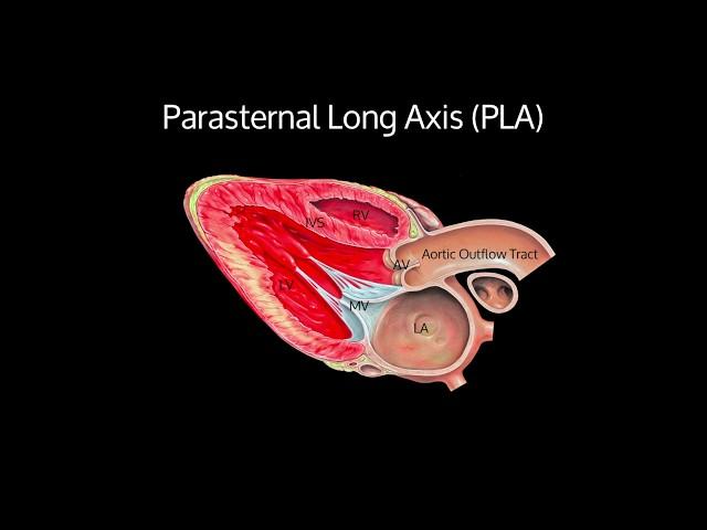 Basic Transthoracic Echocardiography (Cardiac Ultrasound) - TTE Made Simple