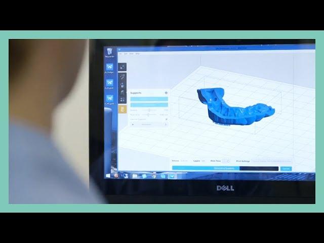 Dental Resin for 3D Printed Surgical Guides