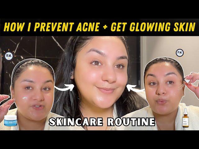 How i Prevent Comedonal Acne + Get Glowing Skin At The Same Time :)