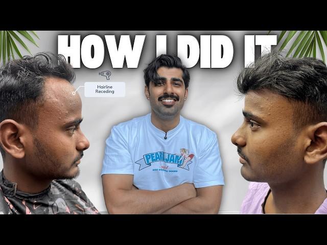 6-Month Transformation: How to Reverse Receding Hairline, Hair Loss & Thinning Naturally | Mridul