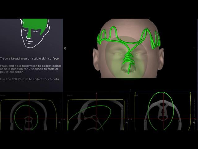 StealthStation™ ENT navigation system Video