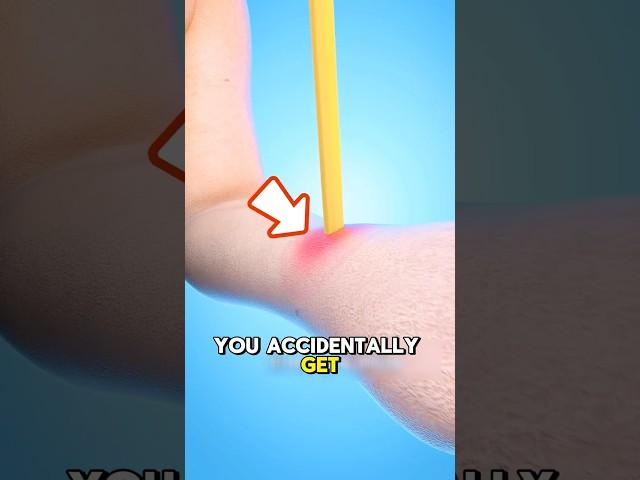 What to Do If a Pencil Stabs Your Hand