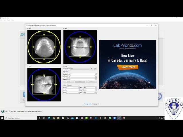 Blue Sky Bio, CBCT Implant Planning ( part 1), DICOM Import & Arch Curve, Dr Khaled Ekram ( Arabic )