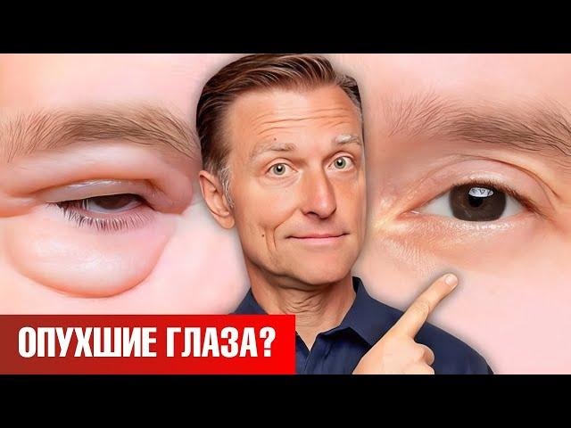 Как убрать мешки под глазами НАВСЕГДА? 