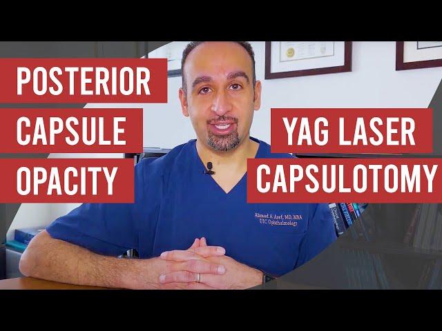 Posterior Capsule Opacity and Yag Laser Capsulotomy