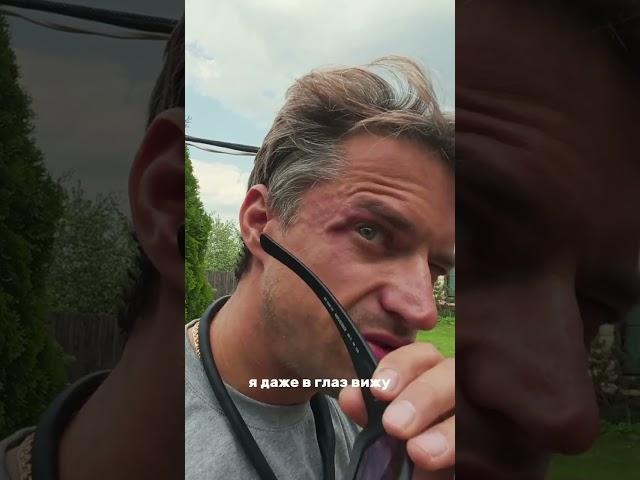 Чуть не лишился глаза 