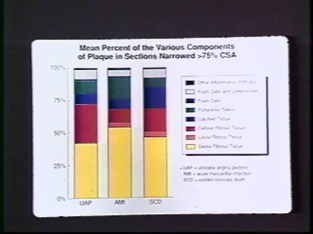 Dolan Lecture Series 1990 - William C. Roberts, MD