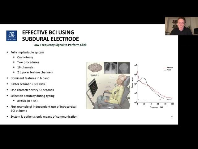 A/Prof Thomas  Oxley - Stentrode brain computer interface