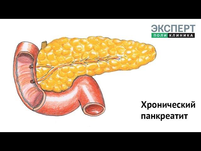 Хронический панкреатит: причины, симптомы, лечение