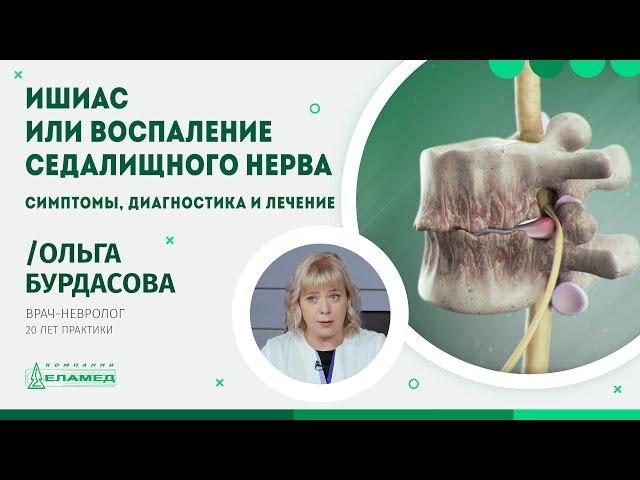 Ишиас или воспаление седалищного нерва. Симптомы, диагностика и лечение | Ольга Бурдасова